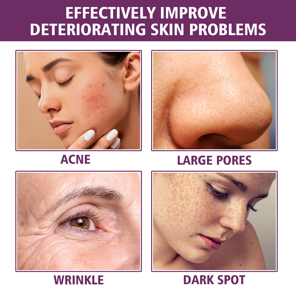 Anti Wrinkle Serum